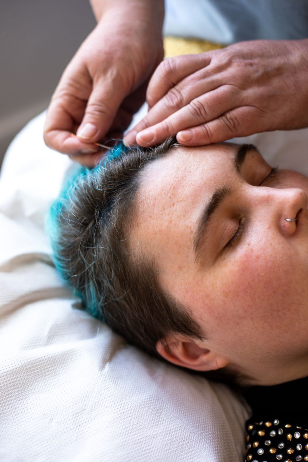 Close-up of a woman receiving acupuncture treatment at Amanda Nordell's Dublin wellness studio. Brand photography by Chiara Gianelli.